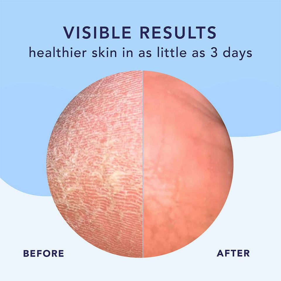 High Dive | Intensive hydration for smoother feet